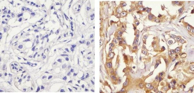 Immunohistochemistry (Formalin/PFA-fixed paraffin-embedded sections) - Anti-Paxillin (phospho S126) antibody (AB24402)