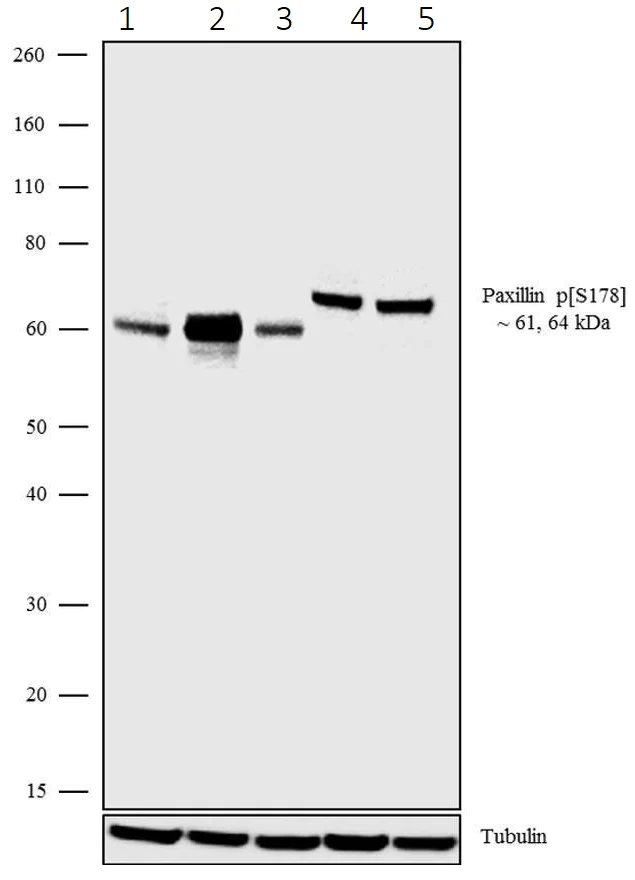 Western blot - Anti-Paxillin (phospho S178) antibody [21HCLC] (AB277786)