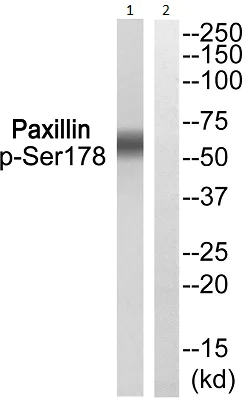 Western blot - Anti-Paxillin (phospho S178) antibody (AB193677)