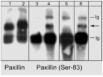 Western blot - Anti-Paxillin (phospho S83) antibody (AB31833)