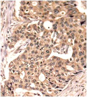 Immunohistochemistry (Formalin/PFA-fixed paraffin-embedded sections) - Anti-Paxillin (phospho Y118) antibody (AB194738)