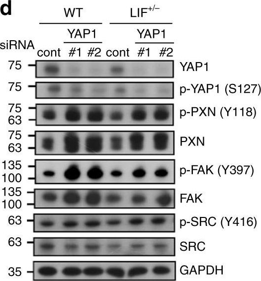 Western blot - Anti-Paxillin (phospho Y118) antibody [EPR1903] (AB109547)