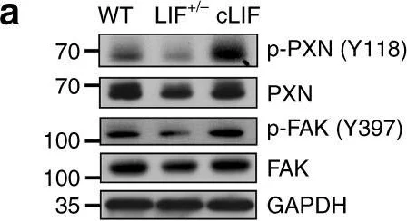Western blot - Anti-Paxillin (phospho Y118) antibody [EPR1903] (AB109547)