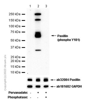 Western blot - Anti-Paxillin (phospho Y181) antibody [EP41(2)Y] (AB76235)