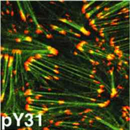 Immunocytochemistry/ Immunofluorescence - Anti-Paxillin (phospho Y31) antibody (AB4832)