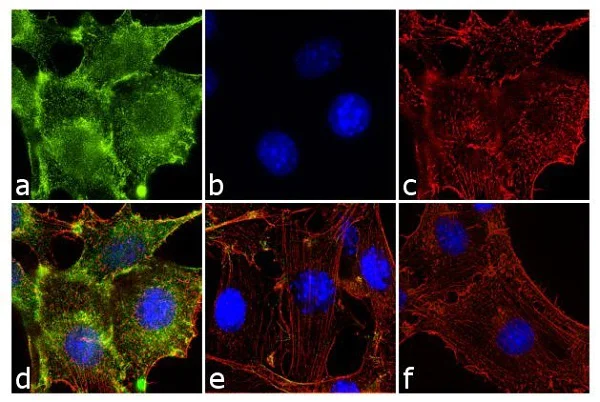 Immunocytochemistry/ Immunofluorescence - Anti-Paxillin (phospho Y31) antibody (AB4832)