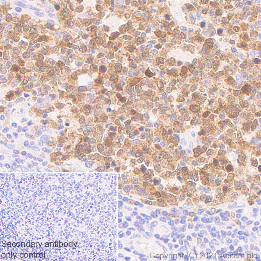 Immunohistochemistry (Formalin/PFA-fixed paraffin-embedded sections) - Anti-PBK/SPK antibody [31/PBK] (AB280209), expandable thumbnail