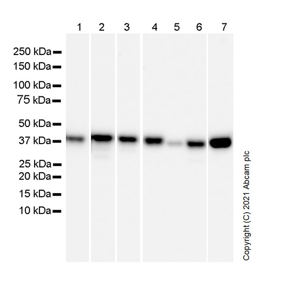 Western blot - Anti-PBK/SPK antibody [31/PBK] (AB280209), expandable thumbnail