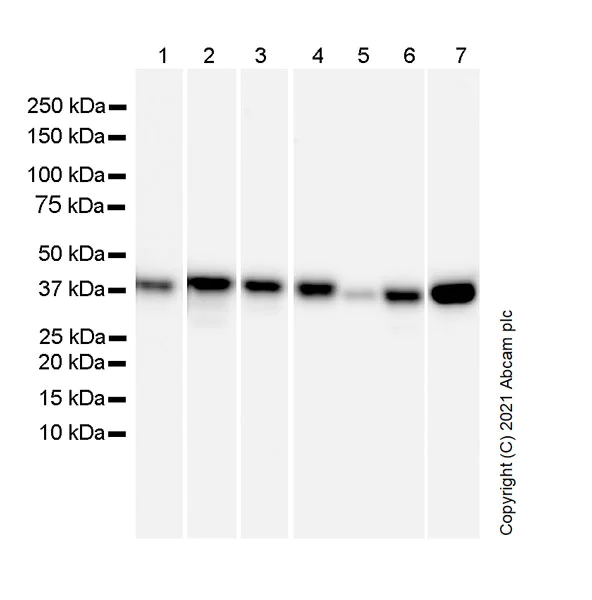 Western blot - Anti-PBK/SPK antibody [31/PBK] (AB280209)