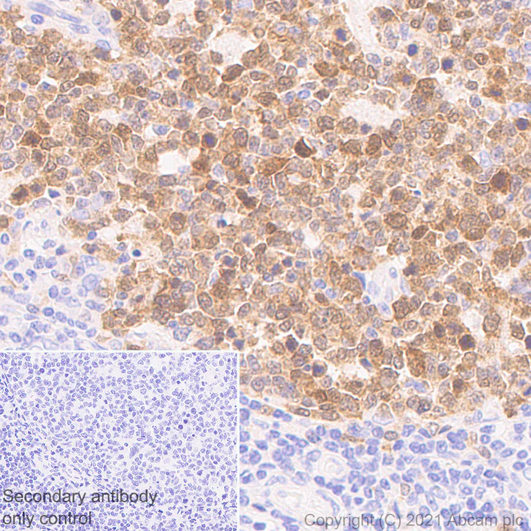 Immunohistochemistry (Formalin/PFA-fixed paraffin-embedded sections) - Anti-PBK/SPK antibody [31/PBK] - BSA and Azide free (AB280216)