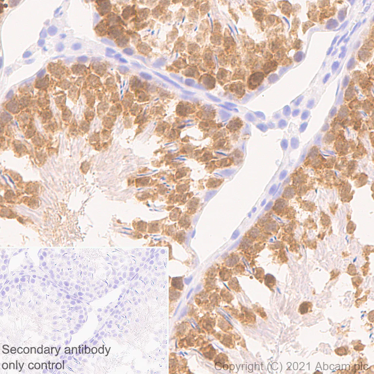 Immunohistochemistry (Formalin/PFA-fixed paraffin-embedded sections) - Anti-PBK/SPK antibody [31/PBK] - BSA and Azide free (AB280216)