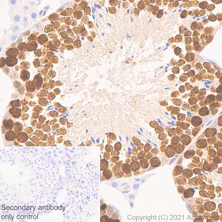 Immunohistochemistry (Formalin/PFA-fixed paraffin-embedded sections) - Anti-PBK/SPK antibody [31/PBK] - BSA and Azide free (AB280216)