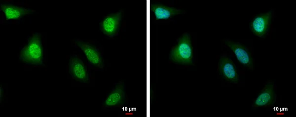 Immunocytochemistry/ Immunofluorescence - Anti-PBK/SPK antibody (AB226923)