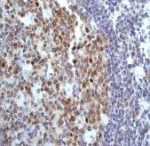 Immunohistochemistry (Formalin/PFA-fixed paraffin-embedded sections) - Anti-PBK/SPK antibody [EP2520Y] - BSA and Azide free (AB247421)