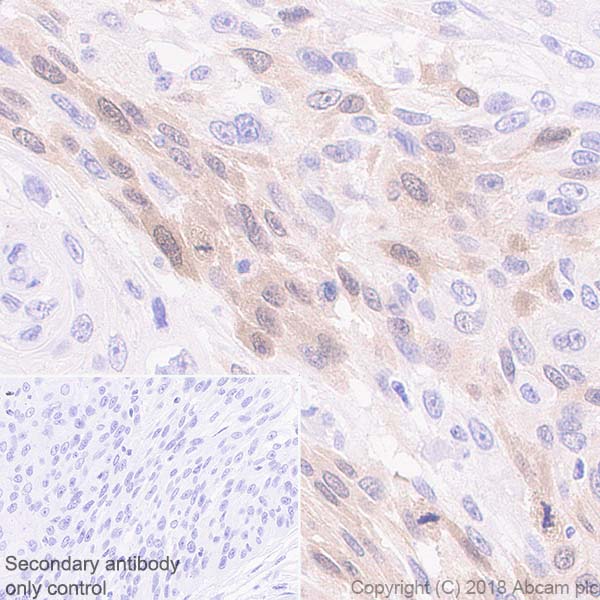 Immunohistochemistry (Formalin/PFA-fixed paraffin-embedded sections) - Anti-PBK/SPK antibody [EPR21982] (ab236871), expandable thumbnail