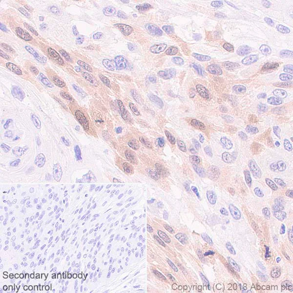 Immunohistochemistry (Formalin/PFA-fixed paraffin-embedded sections) - Anti-PBK/SPK antibody [EPR21982] (AB236871)