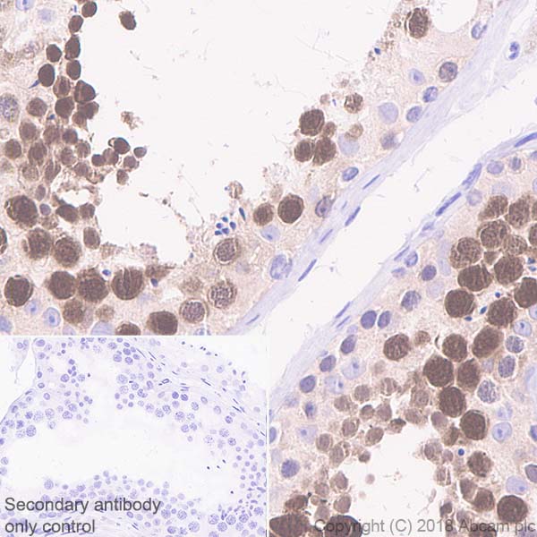 Immunohistochemistry (Formalin/PFA-fixed paraffin-embedded sections) - Anti-PBK/SPK antibody [EPR21982] (AB236871), expandable thumbnail