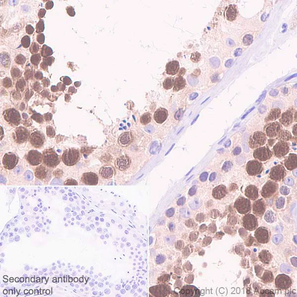 Immunohistochemistry (Formalin/PFA-fixed paraffin-embedded sections) - Anti-PBK/SPK antibody [EPR21982] (AB236871)