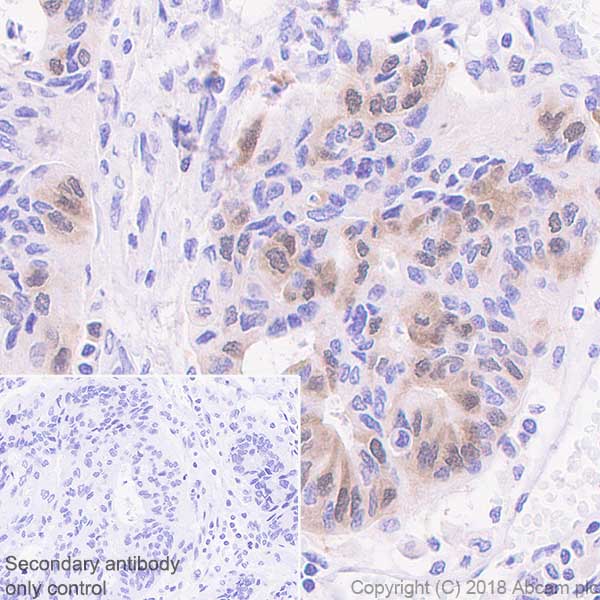 Immunohistochemistry (Formalin/PFA-fixed paraffin-embedded sections) - Anti-PBK/SPK antibody [EPR21982] (ab236871), expandable thumbnail