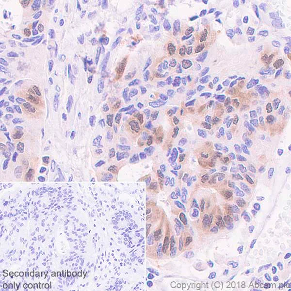 Immunohistochemistry (Formalin/PFA-fixed paraffin-embedded sections) - Anti-PBK/SPK antibody [EPR21982] (AB236871)