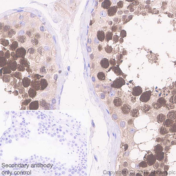 Immunohistochemistry (Formalin/PFA-fixed paraffin-embedded sections) - Anti-PBK/SPK antibody [EPR21983] (AB236872)