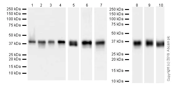 Western blot - Anti-PBK/SPK antibody [EPR21983] (AB236872)