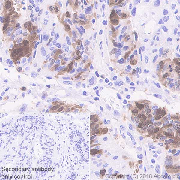 Immunohistochemistry (Formalin/PFA-fixed paraffin-embedded sections) - Anti-PBK/SPK antibody [EPR21983] - BSA and Azide free (AB239760)