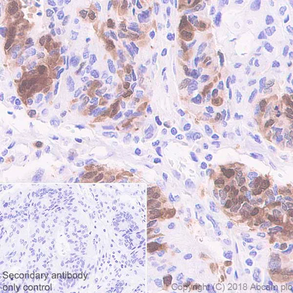 Immunohistochemistry (Formalin/PFA-fixed paraffin-embedded sections) - Anti-PBK/SPK antibody [EPR21983] - BSA and Azide free (AB239760)