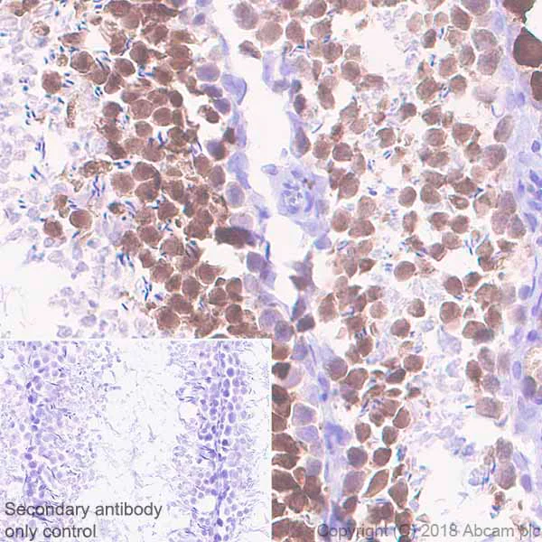 Immunohistochemistry (Formalin/PFA-fixed paraffin-embedded sections) - Anti-PBK/SPK antibody [EPR21983] - BSA and Azide free (AB239760)
