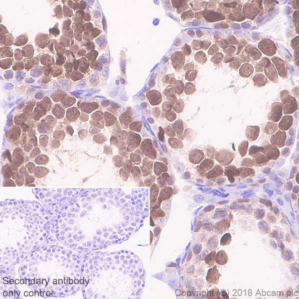 Immunohistochemistry (Formalin/PFA-fixed paraffin-embedded sections) - Anti-PBK/SPK antibody [EPR21983] - BSA and Azide free (AB239760)