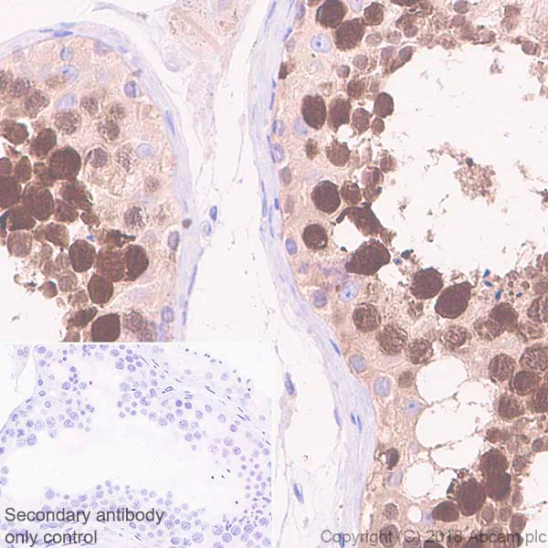 Immunohistochemistry (Formalin/PFA-fixed paraffin-embedded sections) - Anti-PBK/SPK antibody [EPR21983] - BSA and Azide free (AB239760)