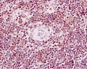 Immunohistochemistry (Formalin/PFA-fixed paraffin-embedded sections) - Anti-PBK/SPK (phospho T9) antibody [EPR2475(N)] (AB184953)