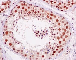 Immunohistochemistry (Formalin/PFA-fixed paraffin-embedded sections) - Anti-PBK/SPK (phospho T9) antibody [EPR2475(N)] - BSA and Azide free (AB250790), expandable thumbnail
