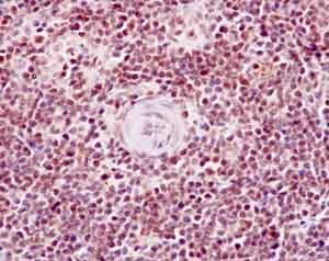 Immunohistochemistry (Formalin/PFA-fixed paraffin-embedded sections) - Anti-PBK/SPK (phospho T9) antibody [EPR2475(N)] - BSA and Azide free (AB250790), expandable thumbnail