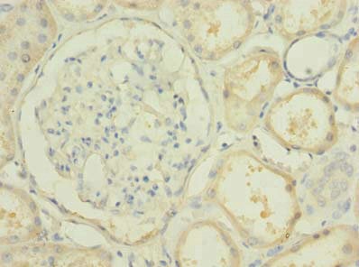 Immunohistochemistry (Formalin/PFA-fixed paraffin-embedded sections) - Anti-PBLD antibody (AB235947)