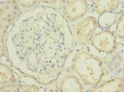 Immunohistochemistry (Formalin/PFA-fixed paraffin-embedded sections) - Anti-PBLD antibody (AB235947)