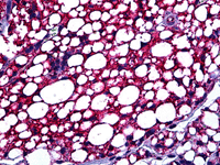 Immunohistochemistry (Formalin/PFA-fixed paraffin-embedded sections) - Anti-PBR antibody (AB118913)