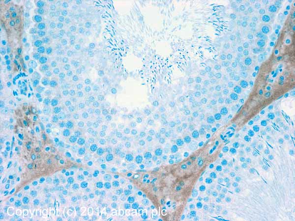 Immunohistochemistry (Formalin/PFA-fixed paraffin-embedded sections) - Anti-PBR antibody (AB154878)