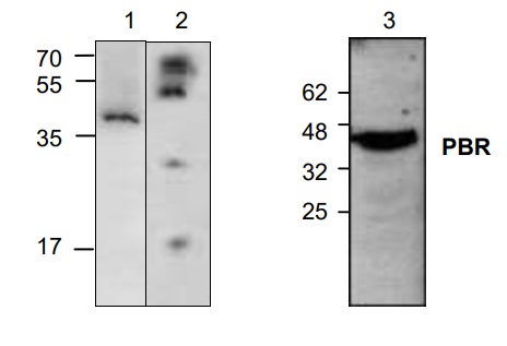 Western blot - Anti-PBR antibody (AB2305), expandable thumbnail