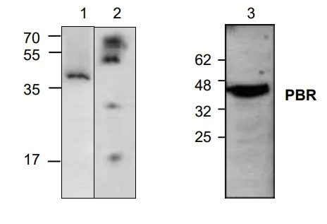 Western blot - Anti-PBR antibody (AB2305)