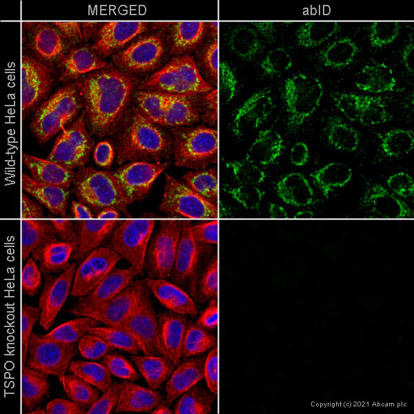 Immunocytochemistry/ Immunofluorescence - Anti-PBR antibody [EPR5384] (AB109497)