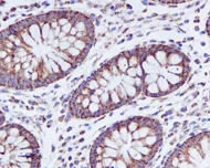 Immunohistochemistry (Formalin/PFA-fixed paraffin-embedded sections) - Anti-PBR antibody [EPR5384] (AB109497)