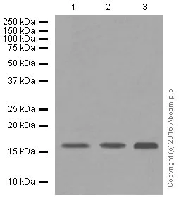 Western blot - Anti-PBR antibody [EPR5384] (AB109497)