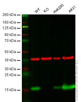 Western blot - Anti-PBR antibody [EPR5384] (AB109497)
