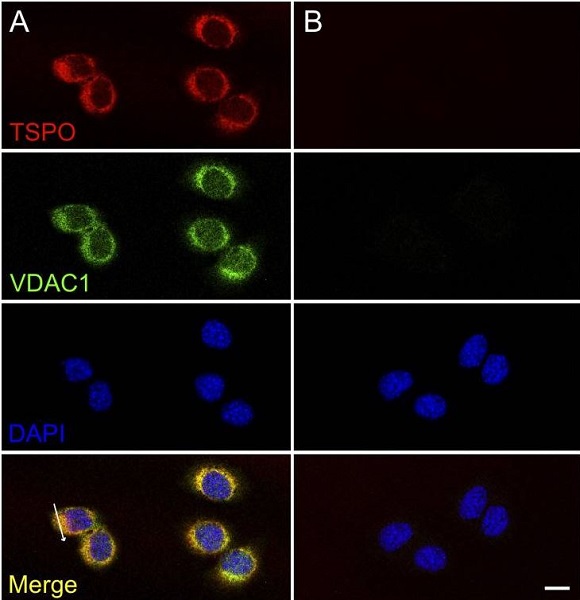 Immunocytochemistry/ Immunofluorescence - Anti-PBR antibody [EPR5384] - BSA and Azide free (AB213654), expandable thumbnail
