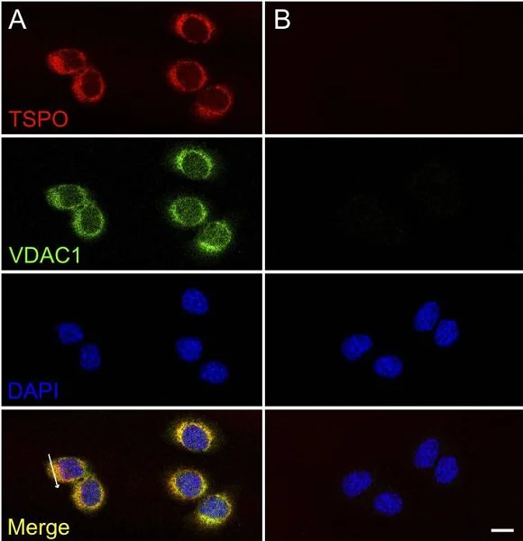 Immunocytochemistry/ Immunofluorescence - Anti-PBR antibody [EPR5384] - BSA and Azide free (AB213654)
