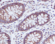 Immunohistochemistry (Formalin/PFA-fixed paraffin-embedded sections) - Anti-PBR antibody [EPR5384] - BSA and Azide free (ab213654), expandable thumbnail