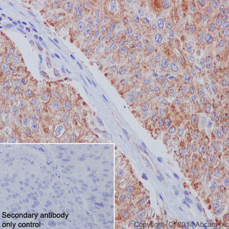 Immunohistochemistry (Formalin/PFA-fixed paraffin-embedded sections) - Anti-PBR antibody [EPR5384] - BSA and Azide free (AB213654), expandable thumbnail