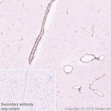Immunohistochemistry (Formalin/PFA-fixed paraffin-embedded sections) - Anti-PBR antibody [EPR5384] - BSA and Azide free (ab213654), expandable thumbnail