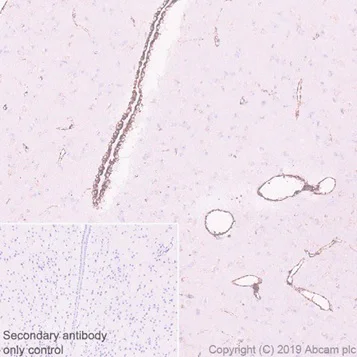 Immunohistochemistry (Formalin/PFA-fixed paraffin-embedded sections) - Anti-PBR antibody [EPR5384] - BSA and Azide free (AB213654)